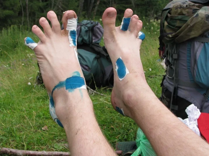 Походтогу мозолдор