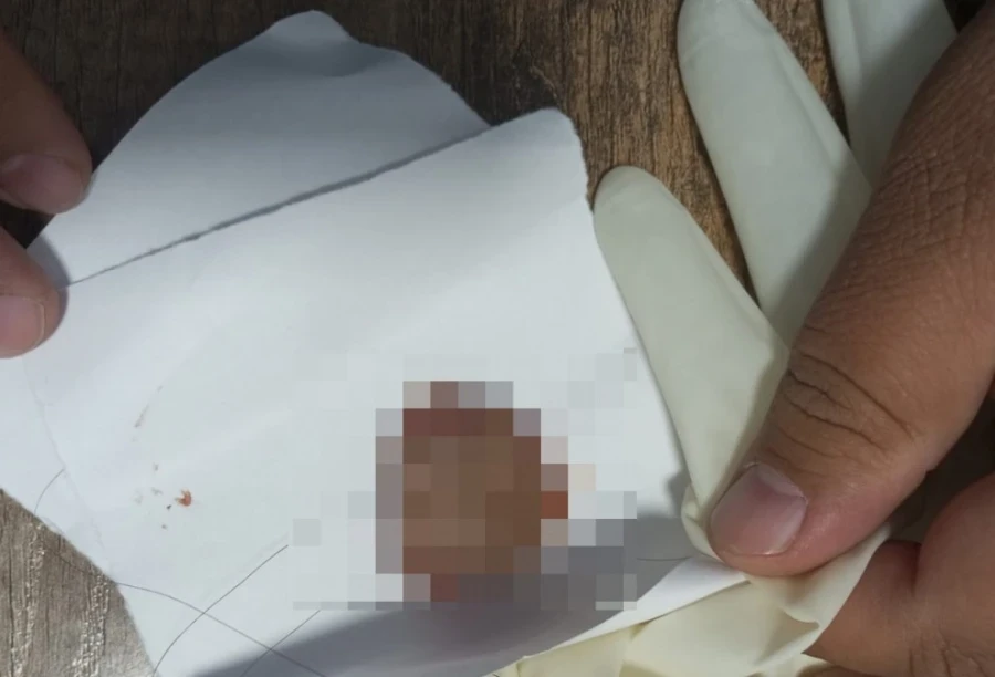 In Manas, a girl bit off a guy's tongue – a psychologist's comment