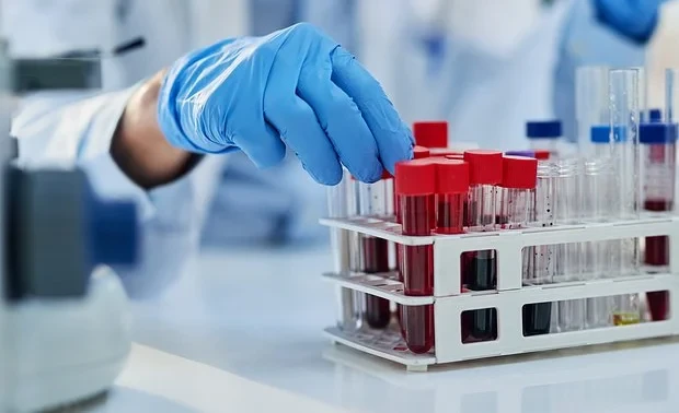 Unusual Structures Found in the Blood of COVID-19 Survivors