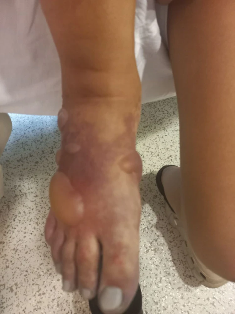 The teenage girl is left without a leg. Her mother blames the doctors (photo, video)