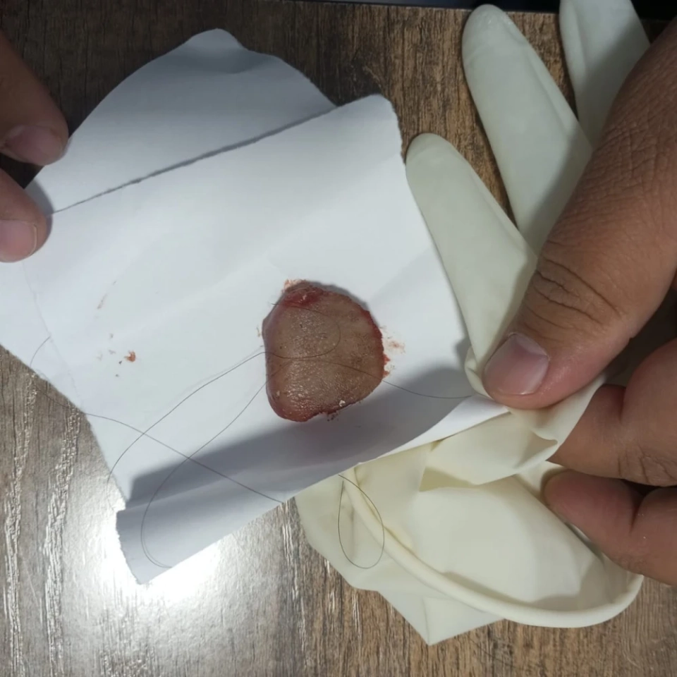 В Манасе девушка откусила язык парню во время поцелуя. В милиции сообщили подробности