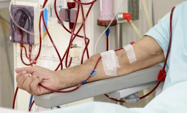 President: The number of citizens on hemodialysis has increased to 4,000