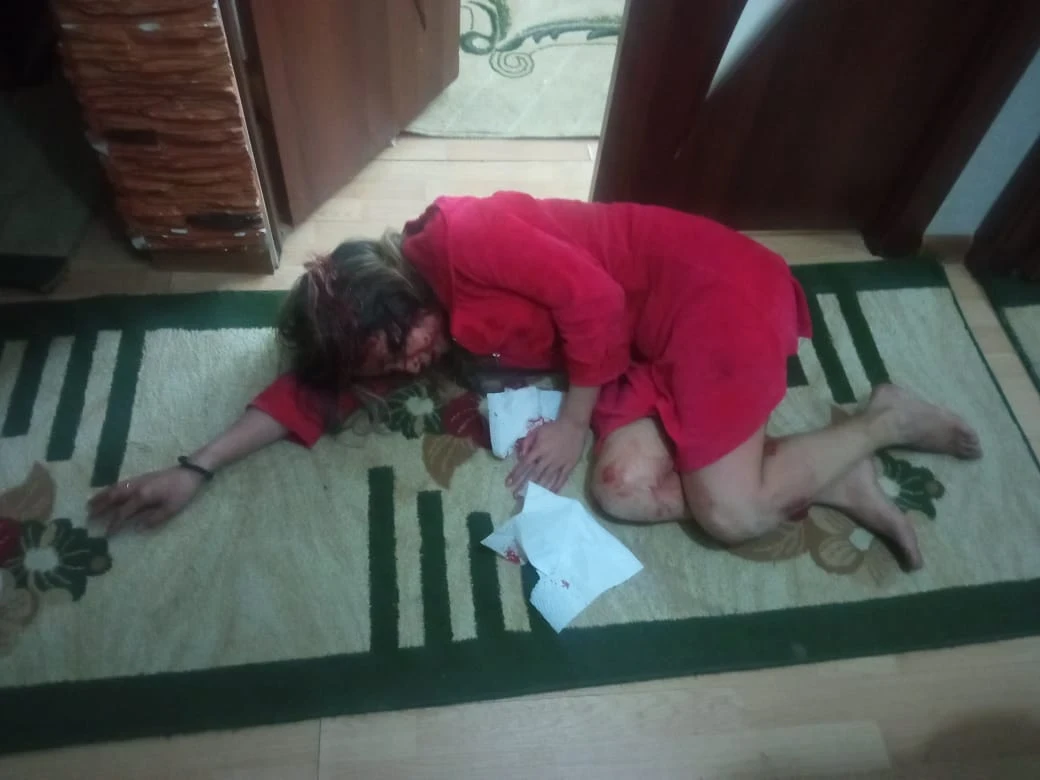 In the city of Osh, a man brutally beat his wife and stabbed her. She is in intensive care.