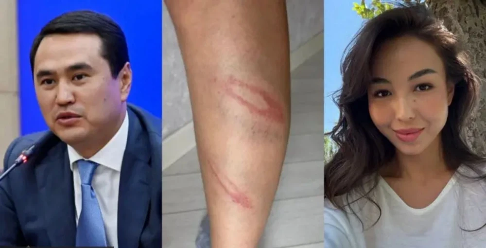 The deputy of the Jogorku Kenesh has been accused of domestic violence. Comment from the GUVD of Bishkek