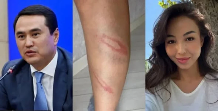 The ex-wife of a member of the Jogorku Kenesh has been issued a protection order. She filed a complaint.