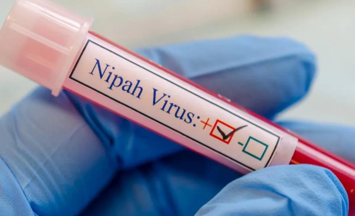 Increased Sanitary Control at the Kyrgyzstan Border to Prevent the Import of Nipah Virus