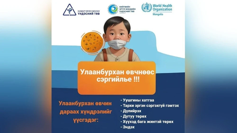 In Mongolia, the number of measles cases has sharply increased to 14,000
