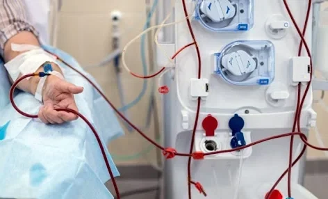 The government plans to switch to direct provision of hemodialysis - Ministry of Health