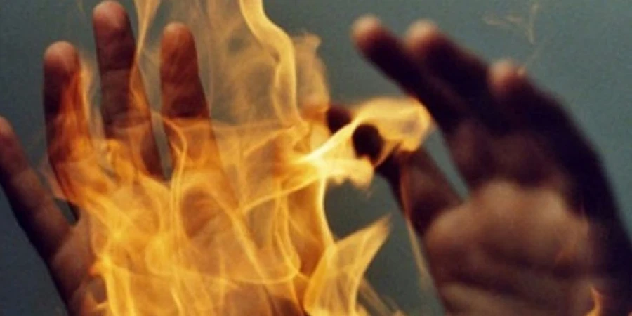 Жительница села Ак-Суу подожгла себя, узнав о беременности несовершеннолетней дочери