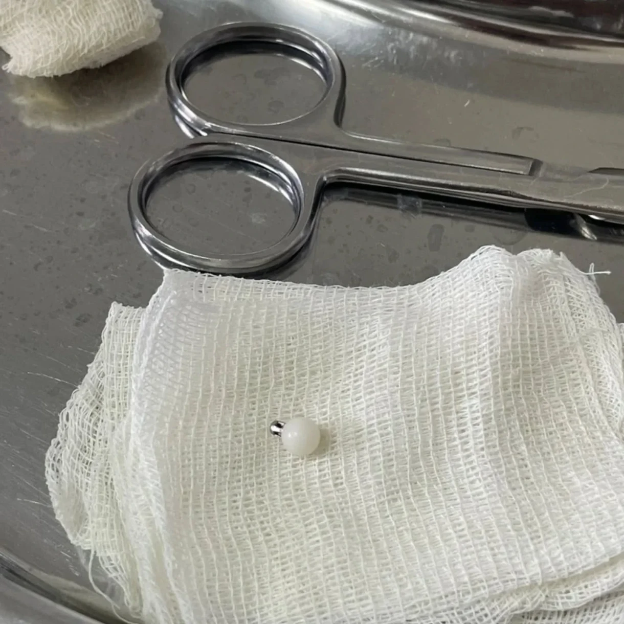 Doctors successfully removed a foreign body from a child's bronchus in Bishkek