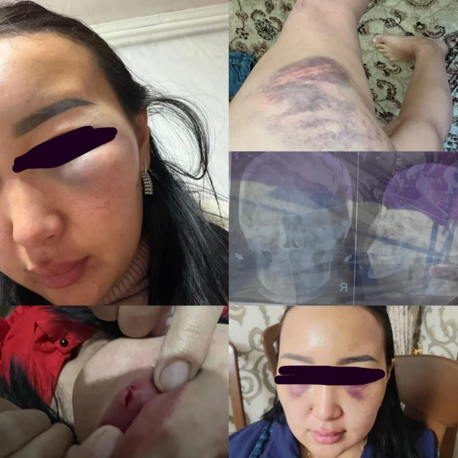 The singer's ex-wife accused him of assault: the court sentenced him to 40 hours of community service.