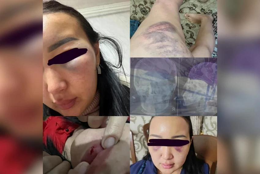 Кызыл-Киде аял мурдагы жолдошун — ырчыны — көп жылдык зомбулукта айыптады