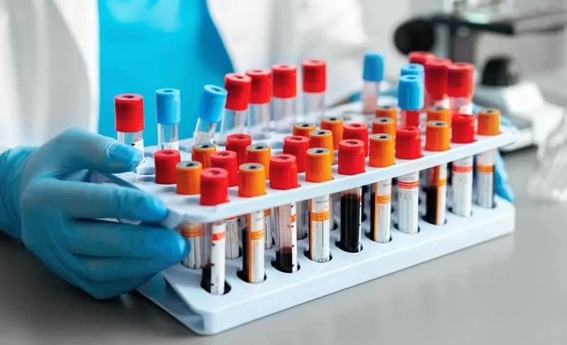 At Bonezkogo, there is a 40% discount for seriously ill patients. They want to raise it again to 50%.