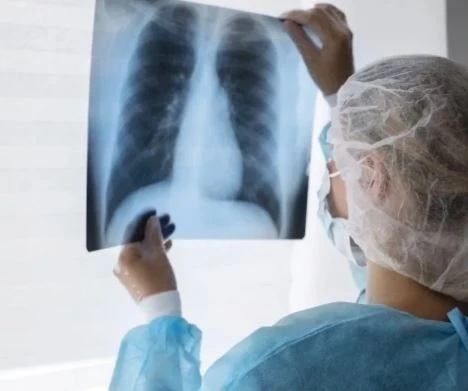 Жогорку соттун кызматкери туберкулёз менен ооруканага жаткырылды