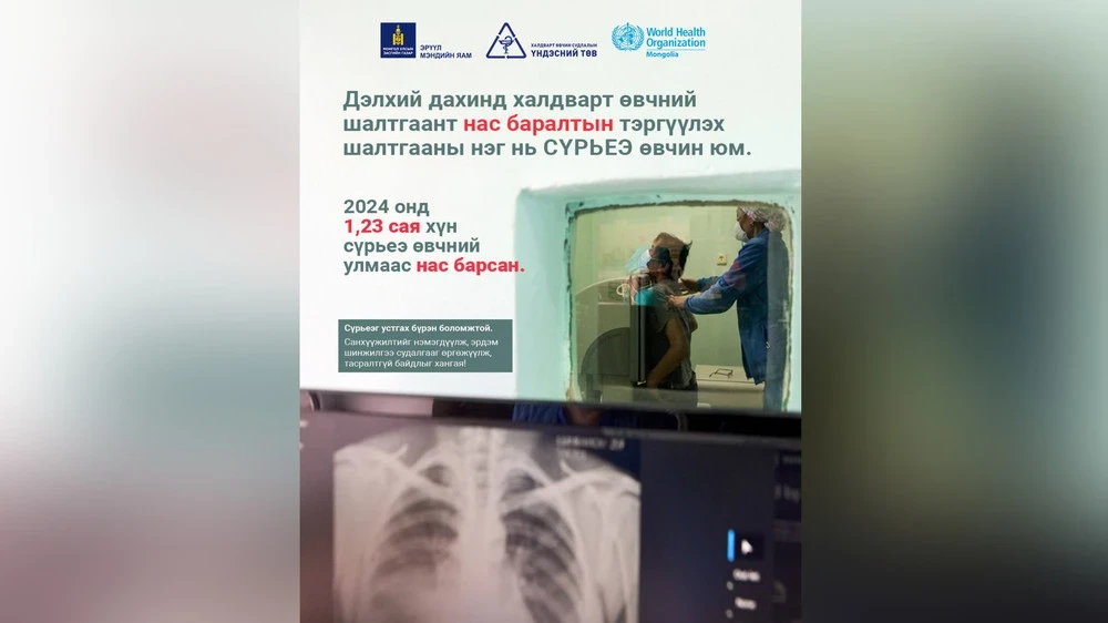 Mongolia with a population of over 3.5 million has achieved significant success in the fight against tuberculosis