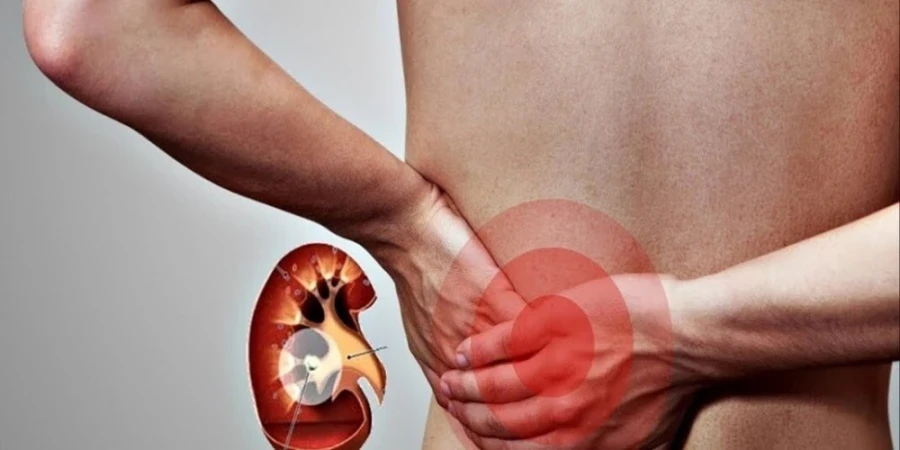 In Kyrgyzstan, a program for the prevention and treatment of kidney diseases has been approved